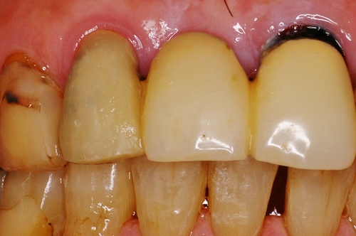 niigata_ whitening_repair2.jpg